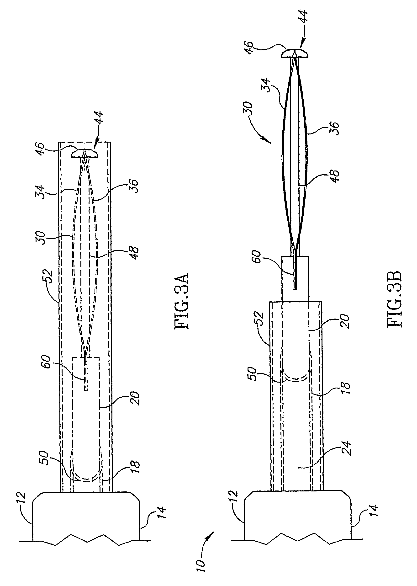 Thermal capsulotomy tool and system