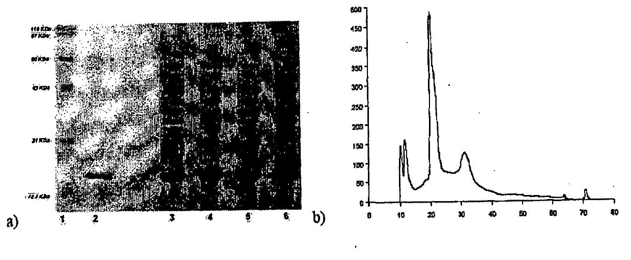 Immunomodulating polypeptides derived from IL-2 and use thereof in cancer and chronic infections