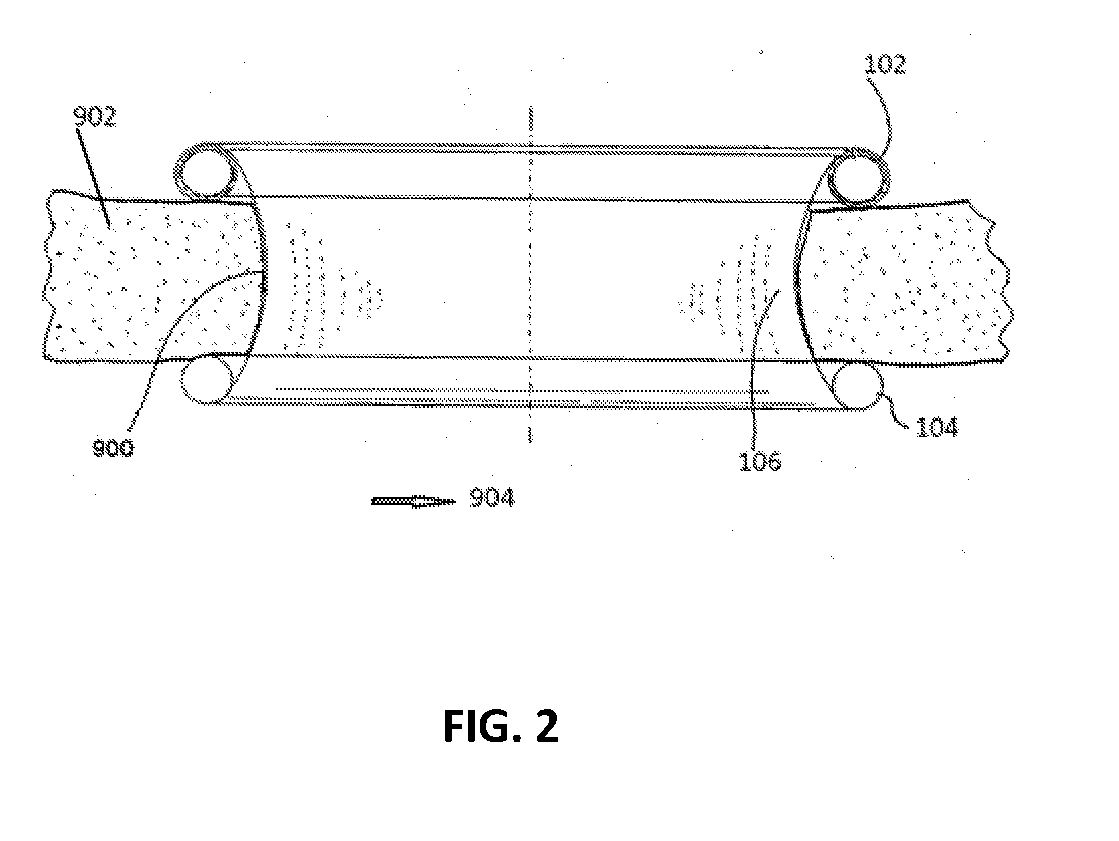 Wound retractors with non-circular, non-coplanar or non-parallel inner rings