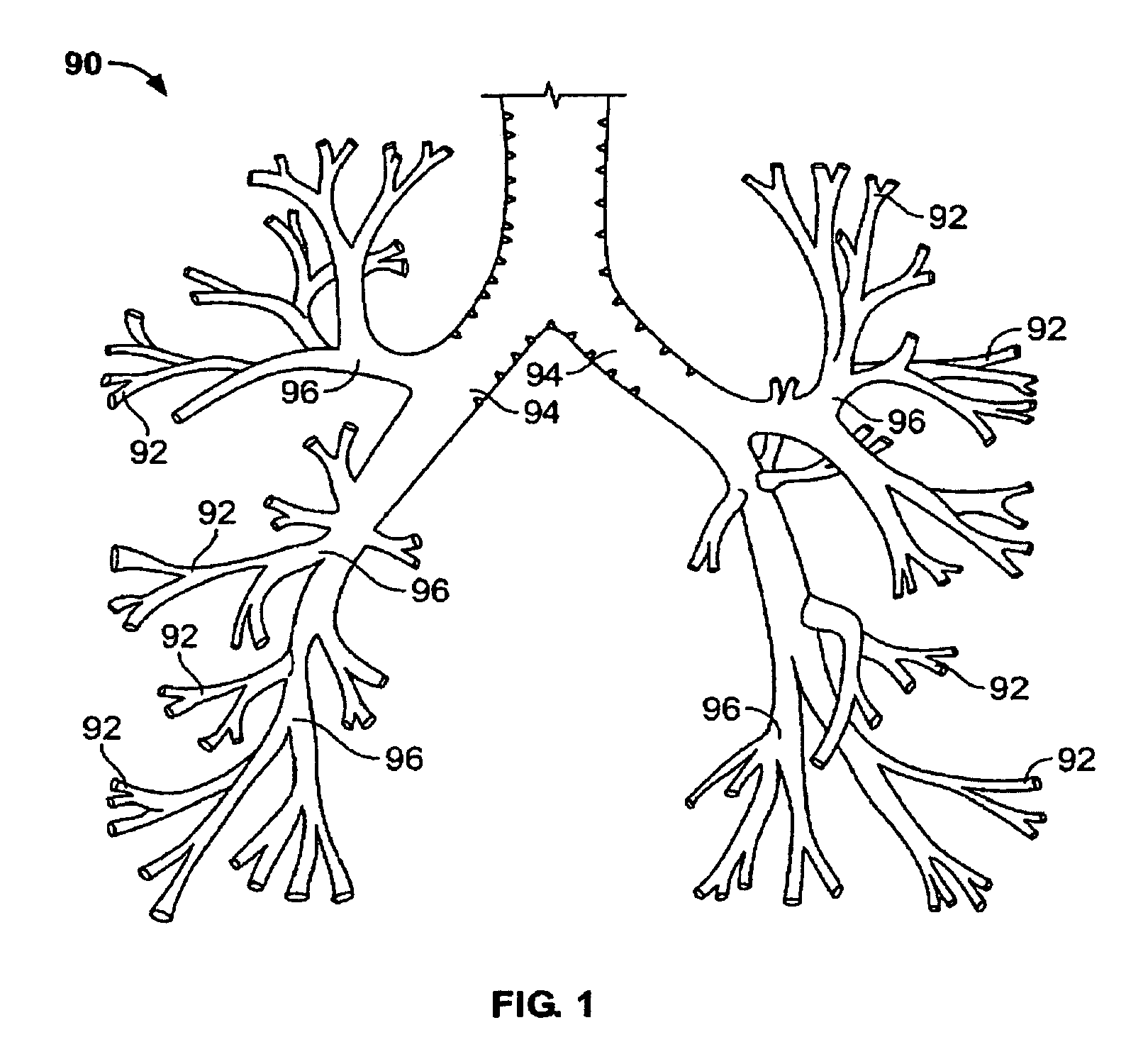 Energy delivery devices and methods