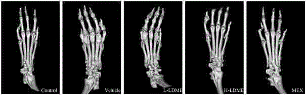 Application of levodopa methyl ester hydrochloride to preparation of drugs for preventing and treating rheumatoid arthritis