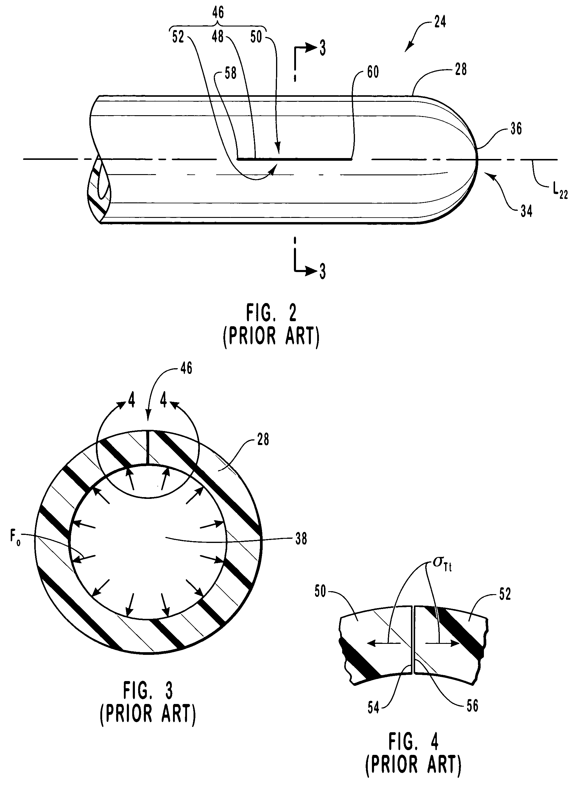 Cardiovascular access catheter with slit valve