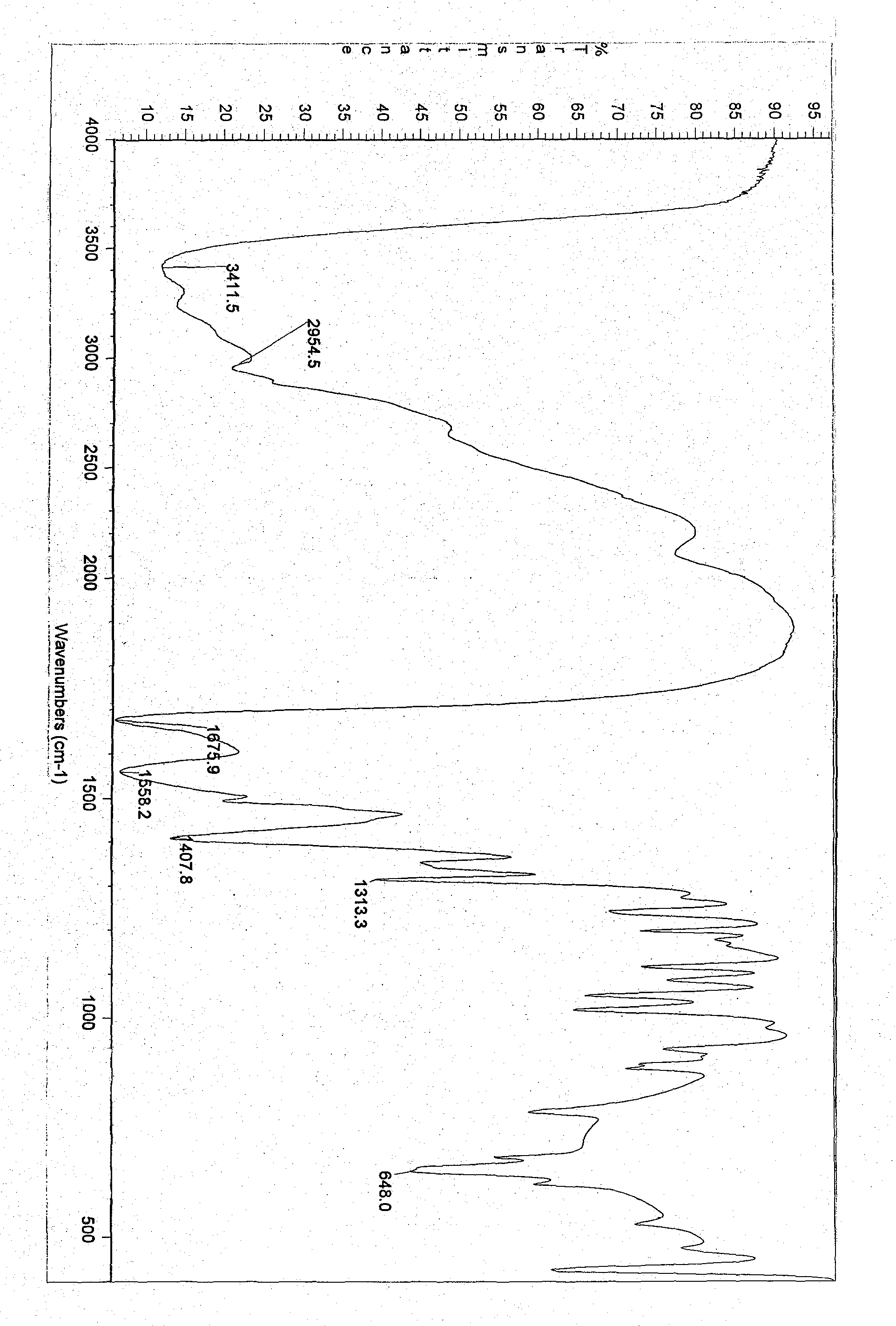 Ornithine aspartate injection and preparation method thereof