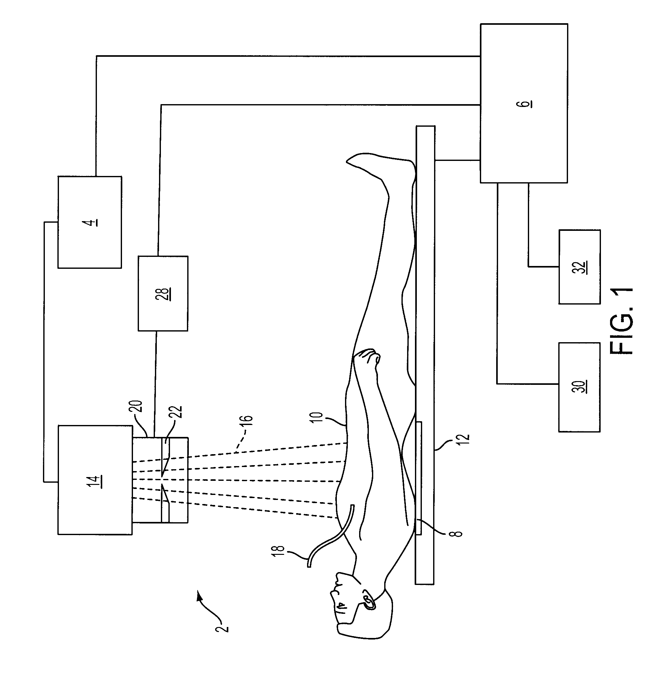 Histogram calculation for auto-windowing of collimated X-ray image