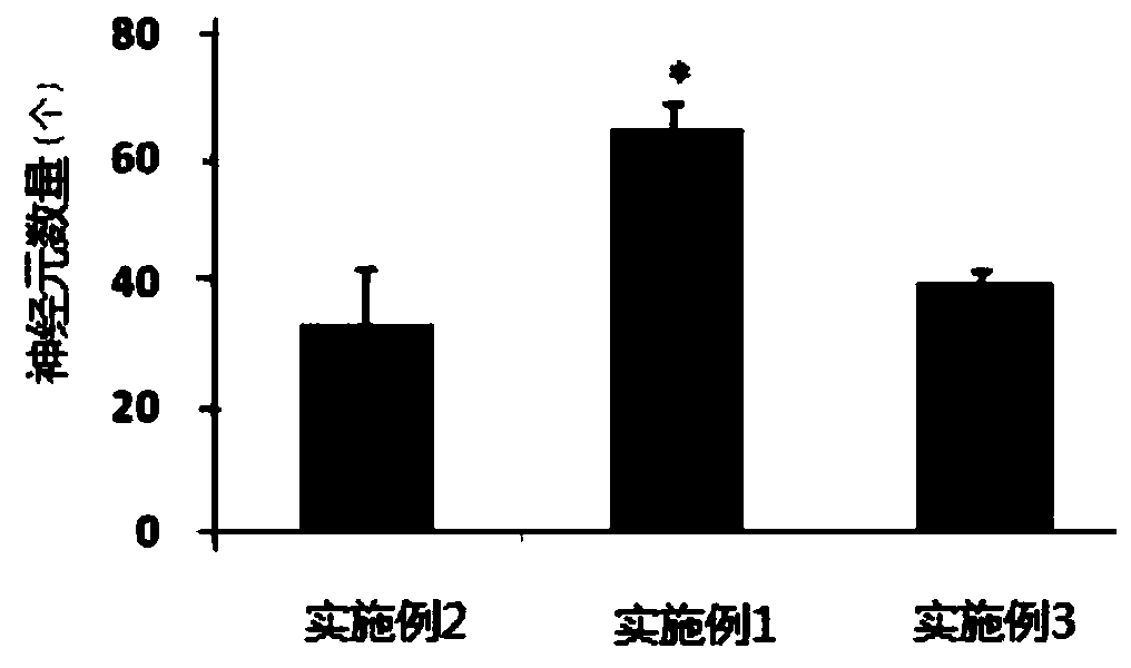 Method for inducing neural stem cells in vitro to directionally differentiate into neurons