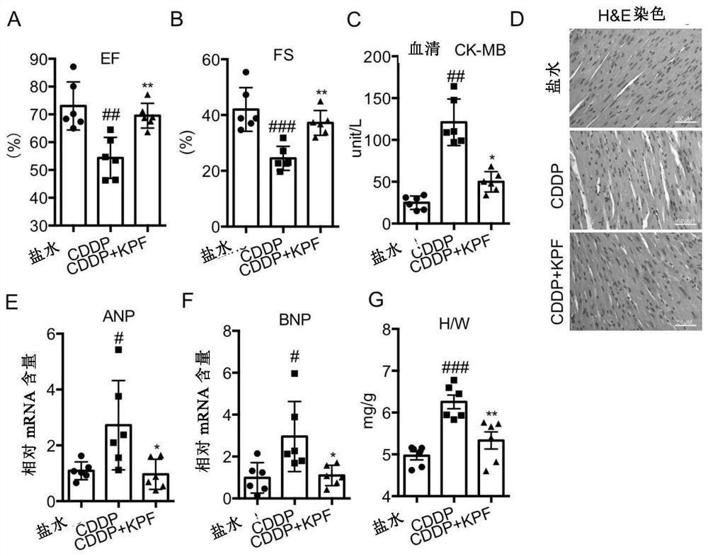 Application of kaempferol in preparation of medicine for treating or improving cardiac injury