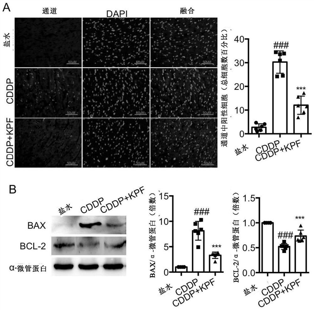 Application of kaempferol in preparation of medicine for treating or improving cardiac injury