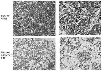 Recombinant plasmid of GSDMD-N (gasdmermin D-N) gene, expression method in mammary gland and application