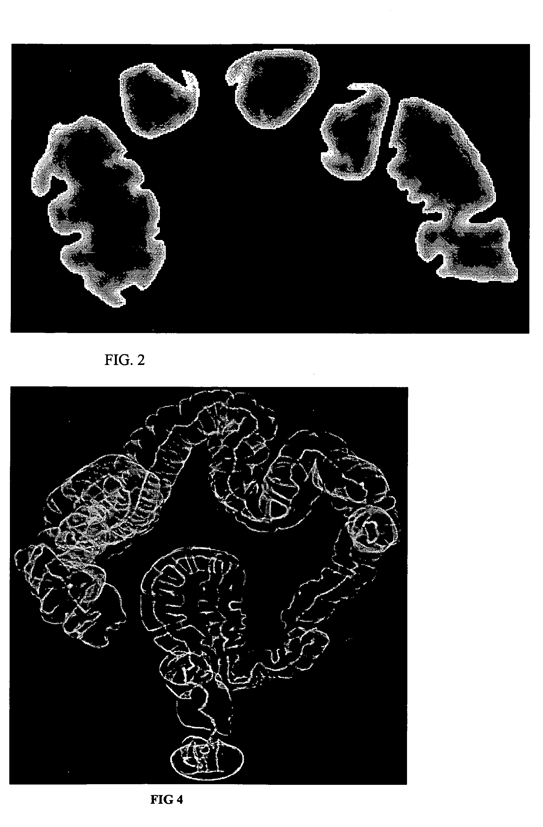 Method of centerline generation in virtual objects