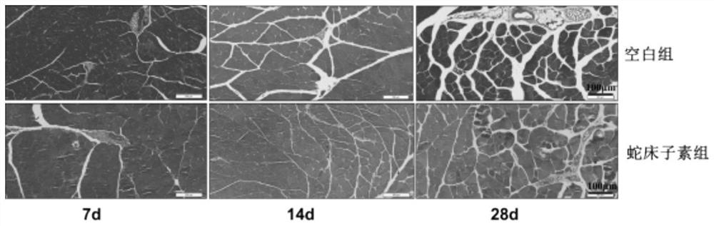 Special preparation of cnidium lactone for improving sarcopenia and muscle atrophy after fracture