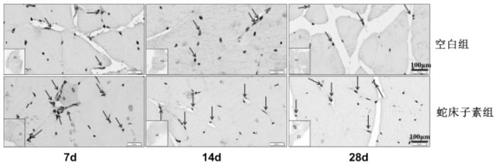 Special preparation of cnidium lactone for improving sarcopenia and muscle atrophy after fracture