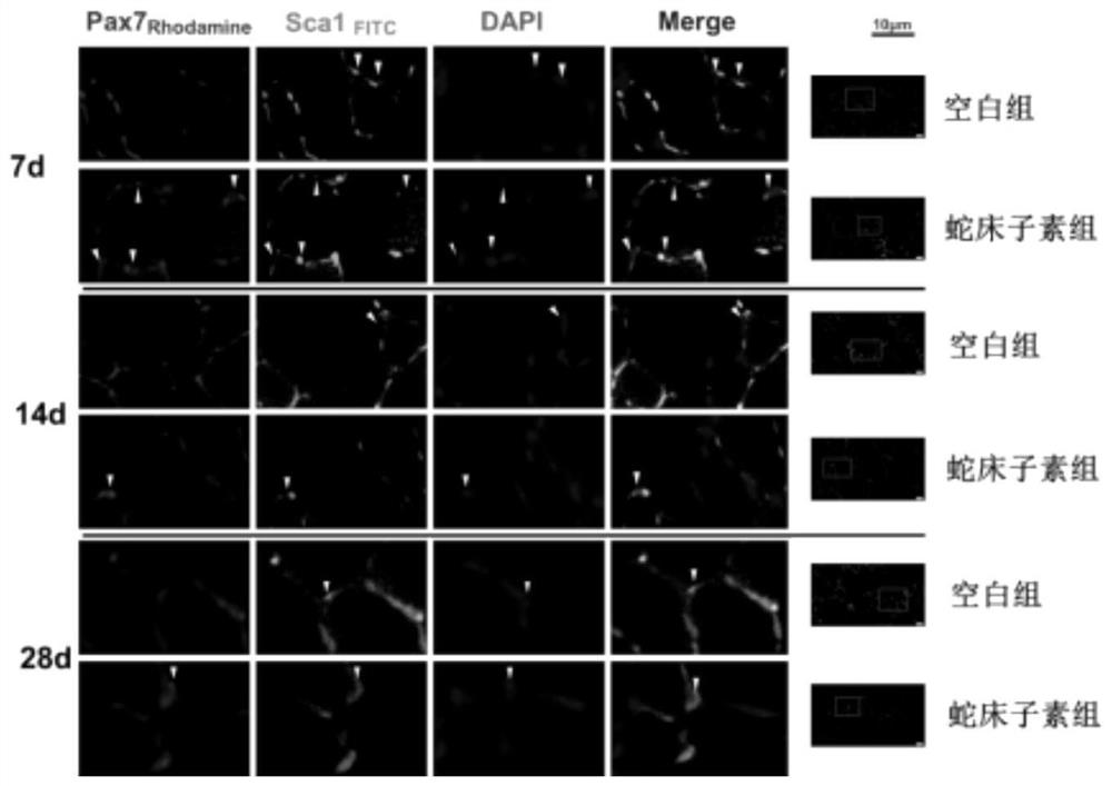 Special preparation of cnidium lactone for improving sarcopenia and muscle atrophy after fracture