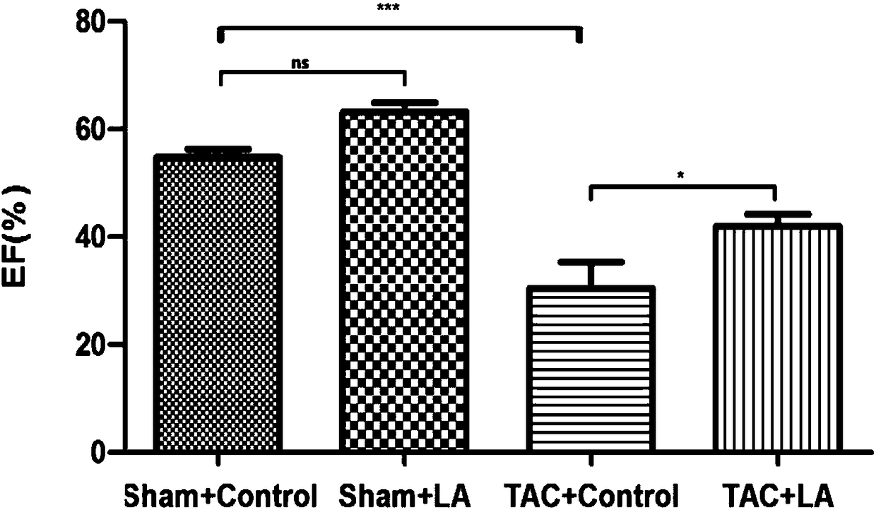 Use of lipoic acid in preparation of pharmaceutical composition for treatment on pressure-loaded myocardial injury