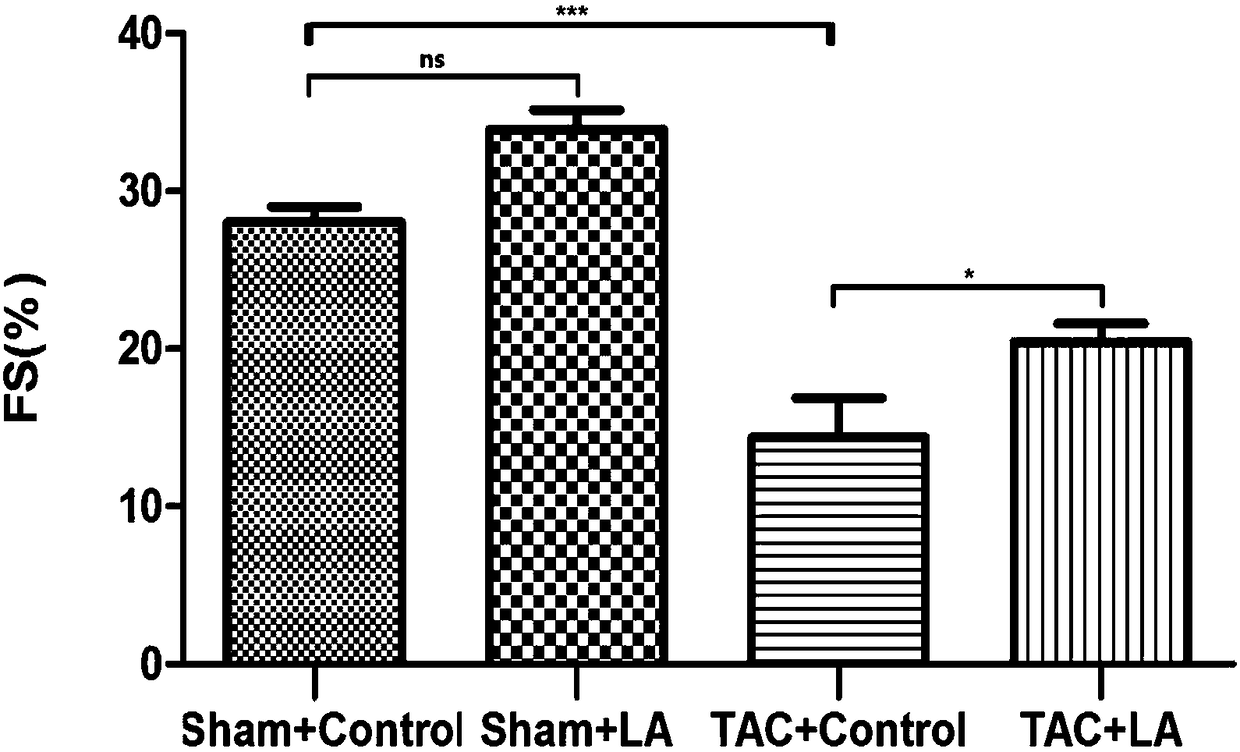 Use of lipoic acid in preparation of pharmaceutical composition for treatment on pressure-loaded myocardial injury