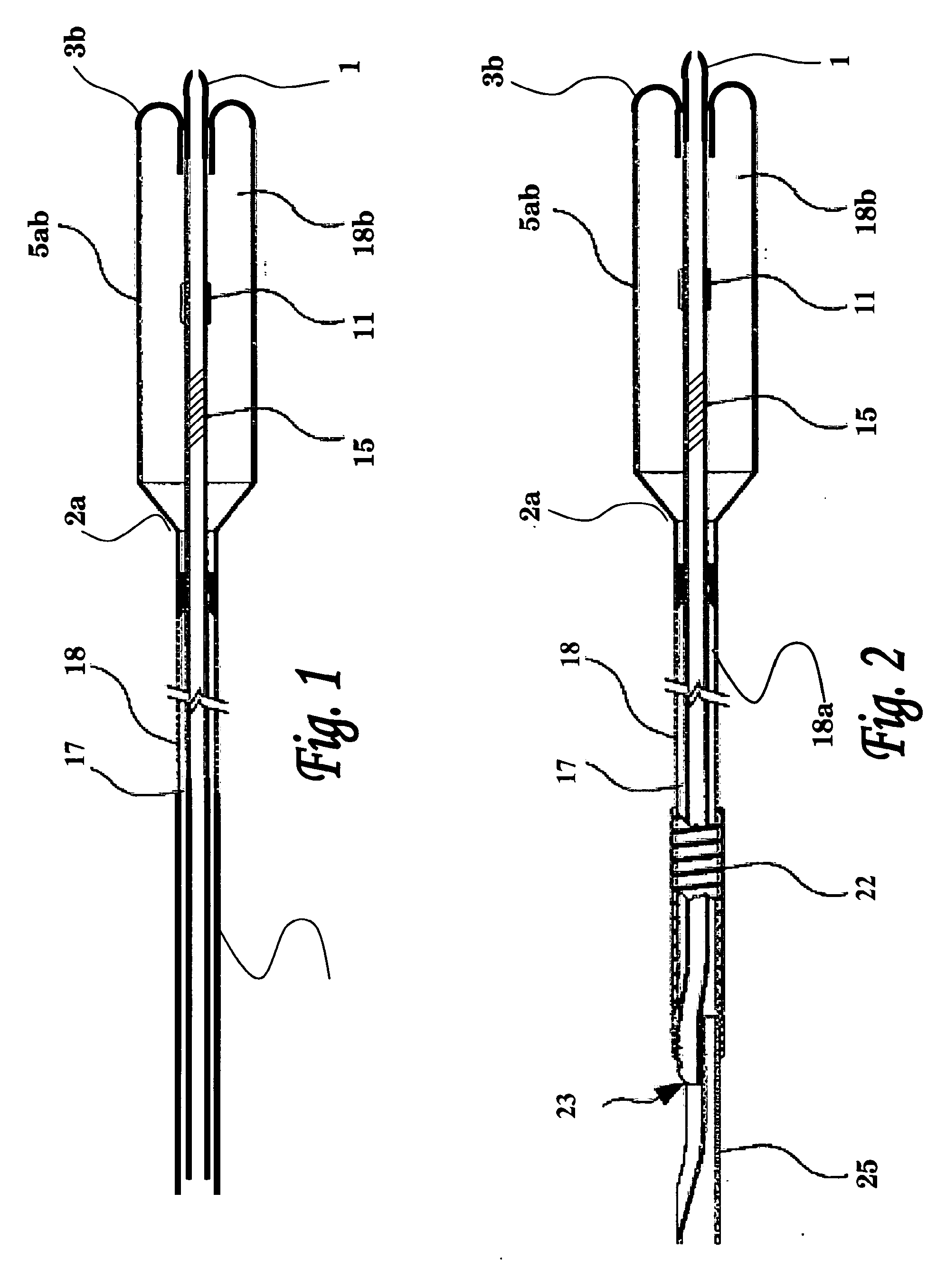 Balloon catheter system for treating vascular occlusions