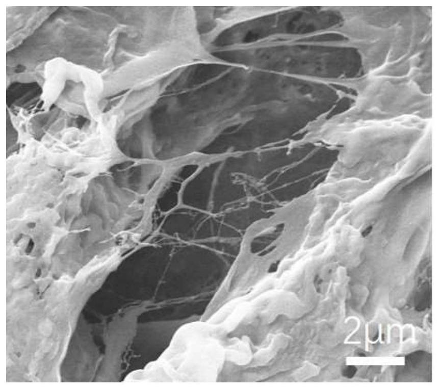 Preparation method of lignin chelated stannous hydrogel