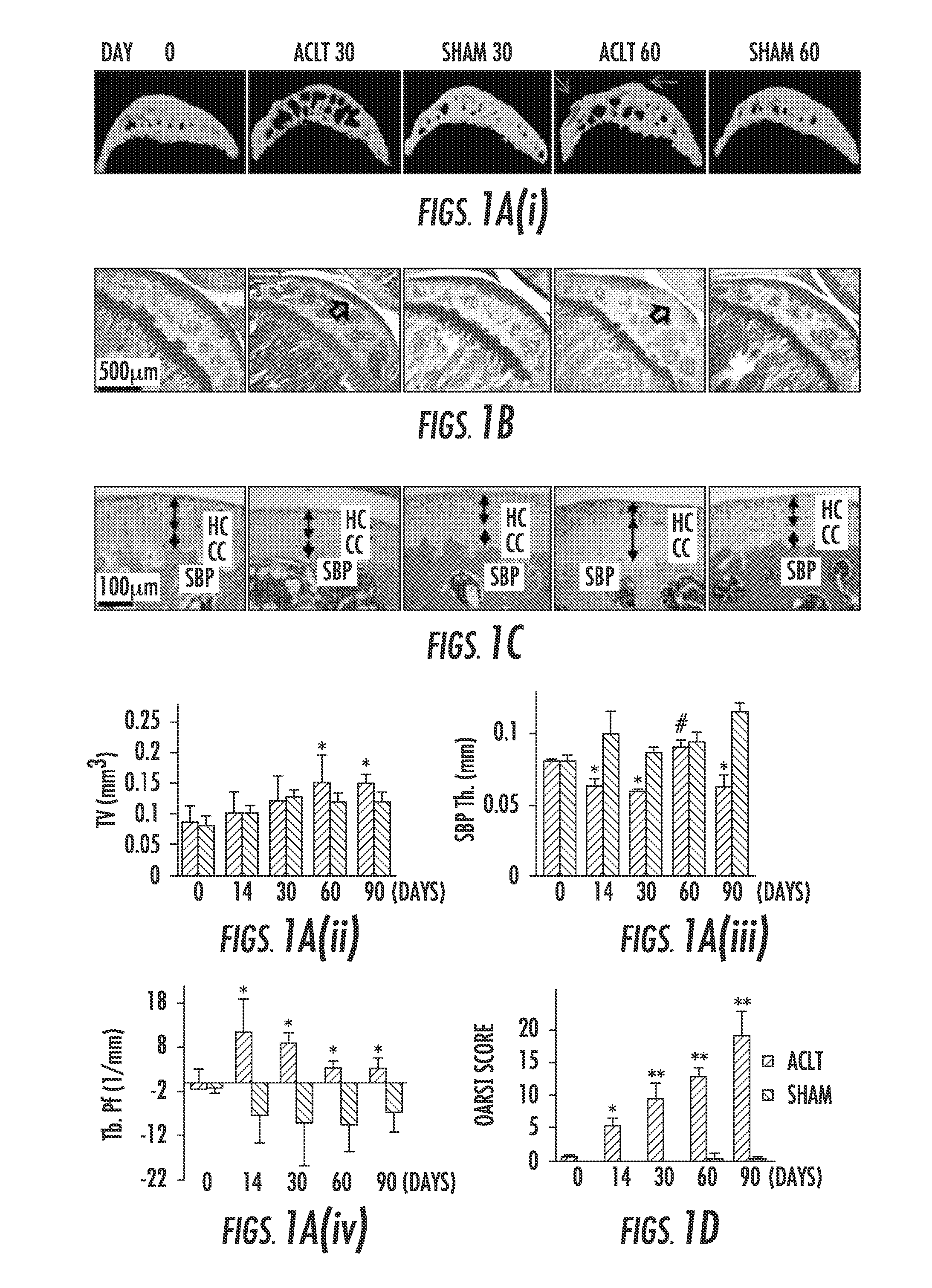 Compositions and methods for treating or preventing osteoarthritis