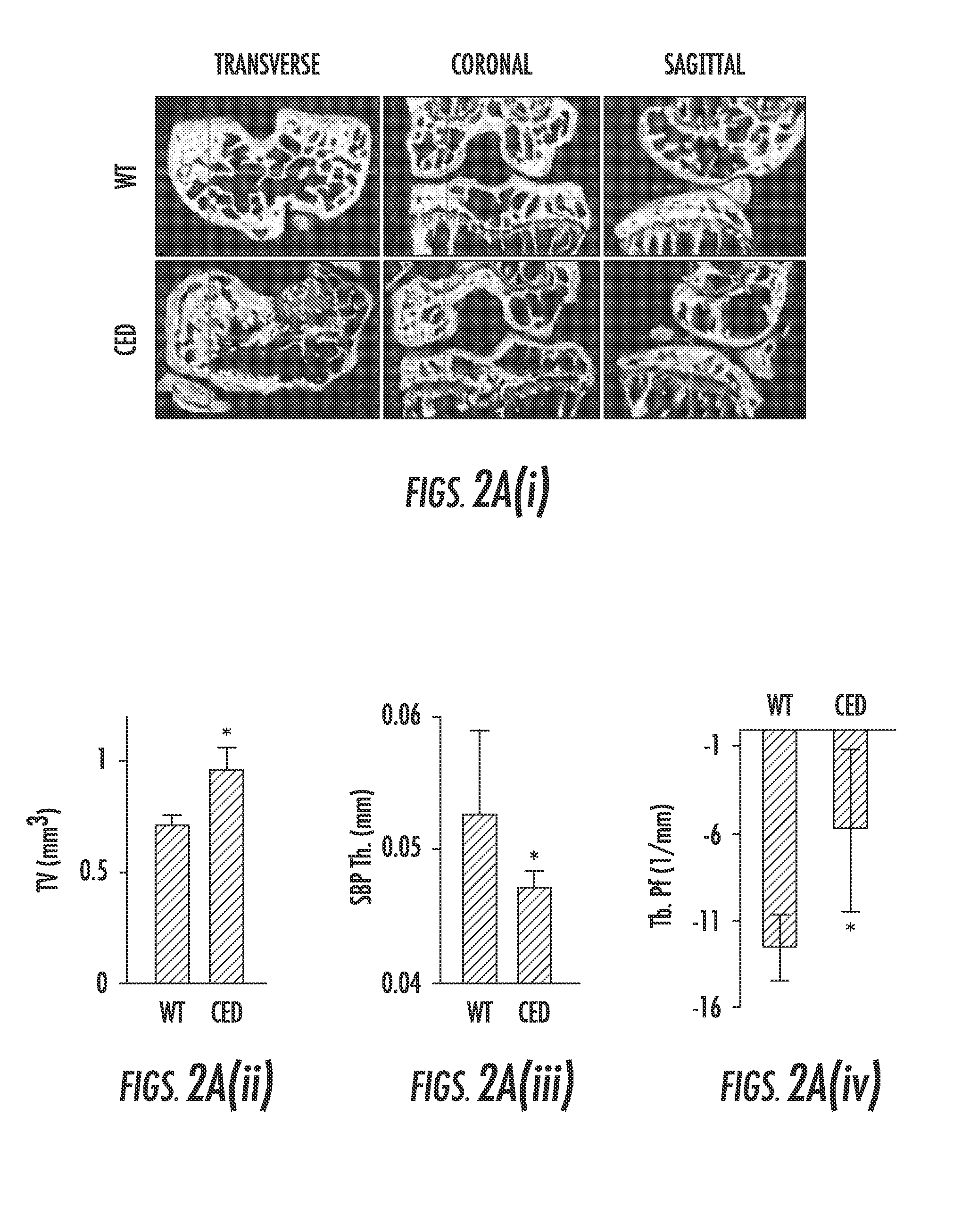 Compositions and methods for treating or preventing osteoarthritis