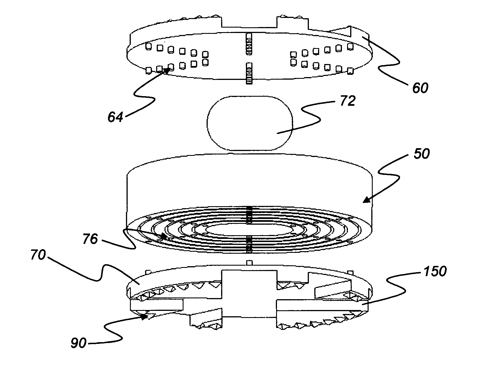 Anatomic total disc replacement