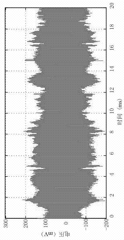 Crosslinked polyethylene high-voltage cable partial discharge feature extraction method