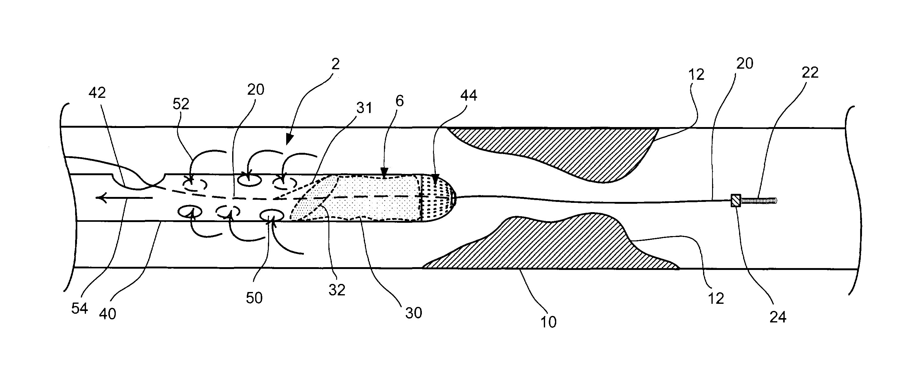 Embolic protection aspirator