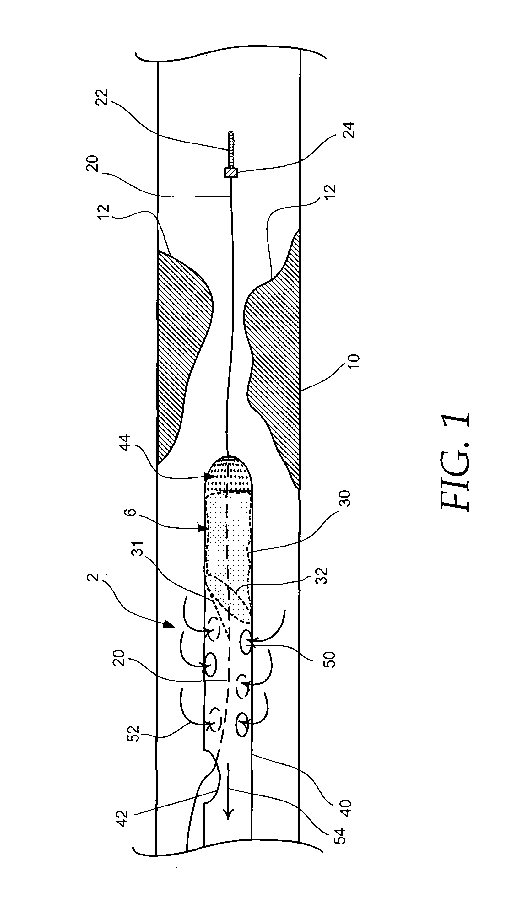 Embolic protection aspirator