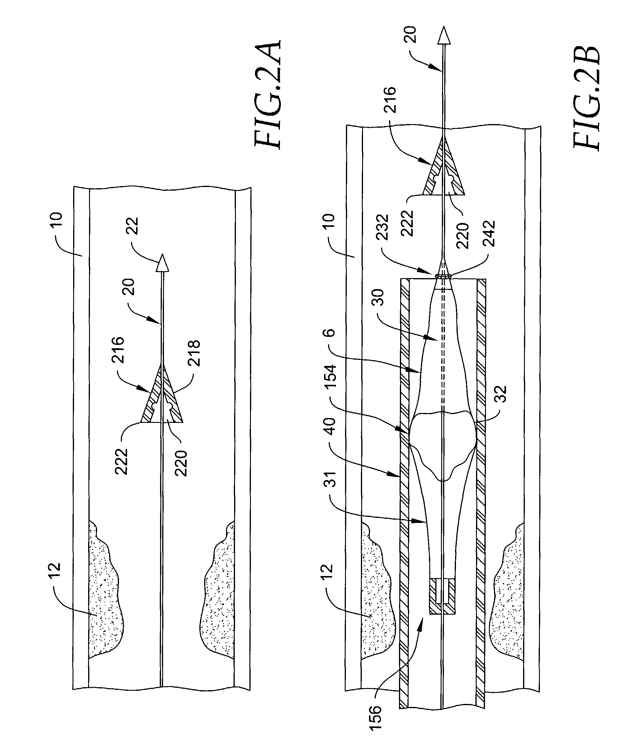 Embolic protection aspirator