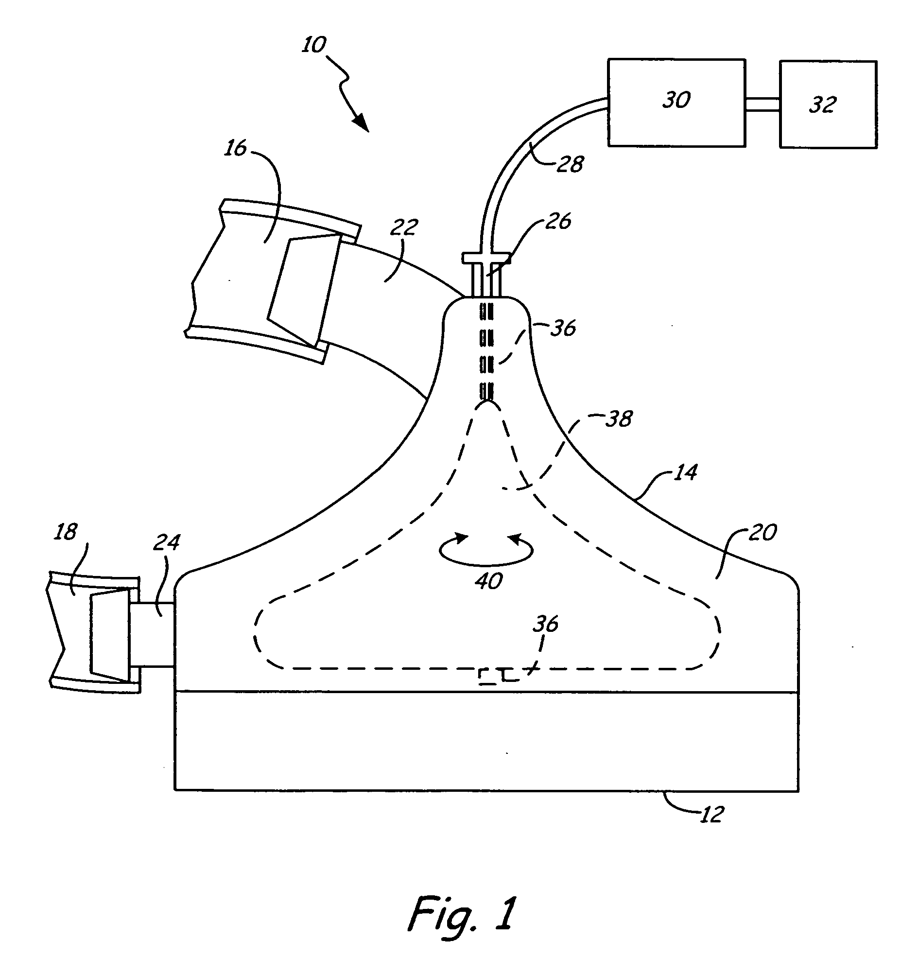 Gas removal from a centrifugal pump