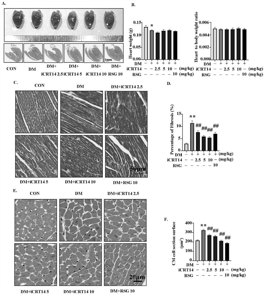 Application of compound in preparation of drug for treating type 2 diabetic cardiomyopathy