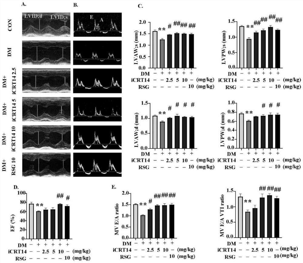 Application of compound in preparation of drug for treating type 2 diabetic cardiomyopathy