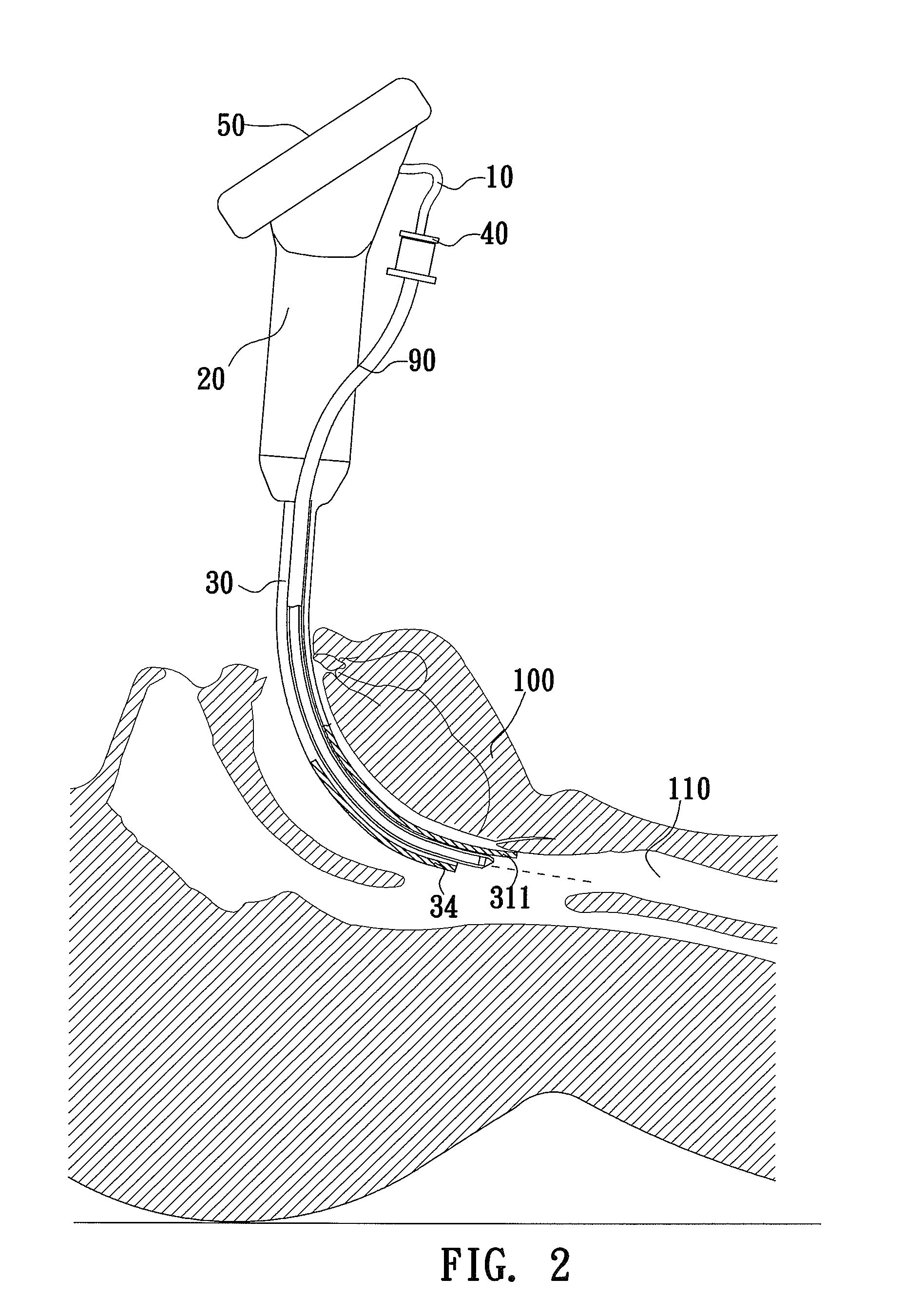 Tracheal Intubation Device