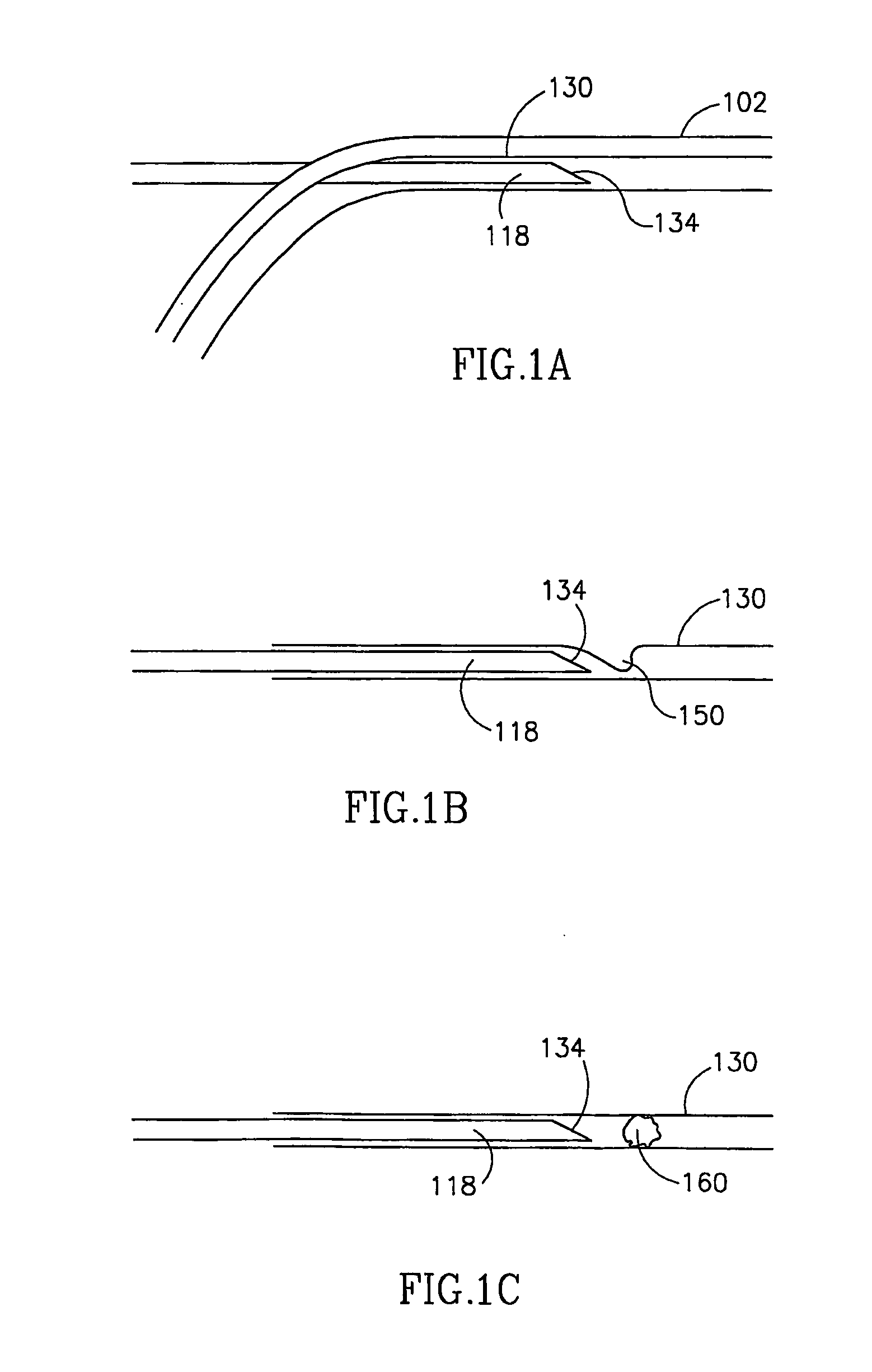 Vascular coupling device