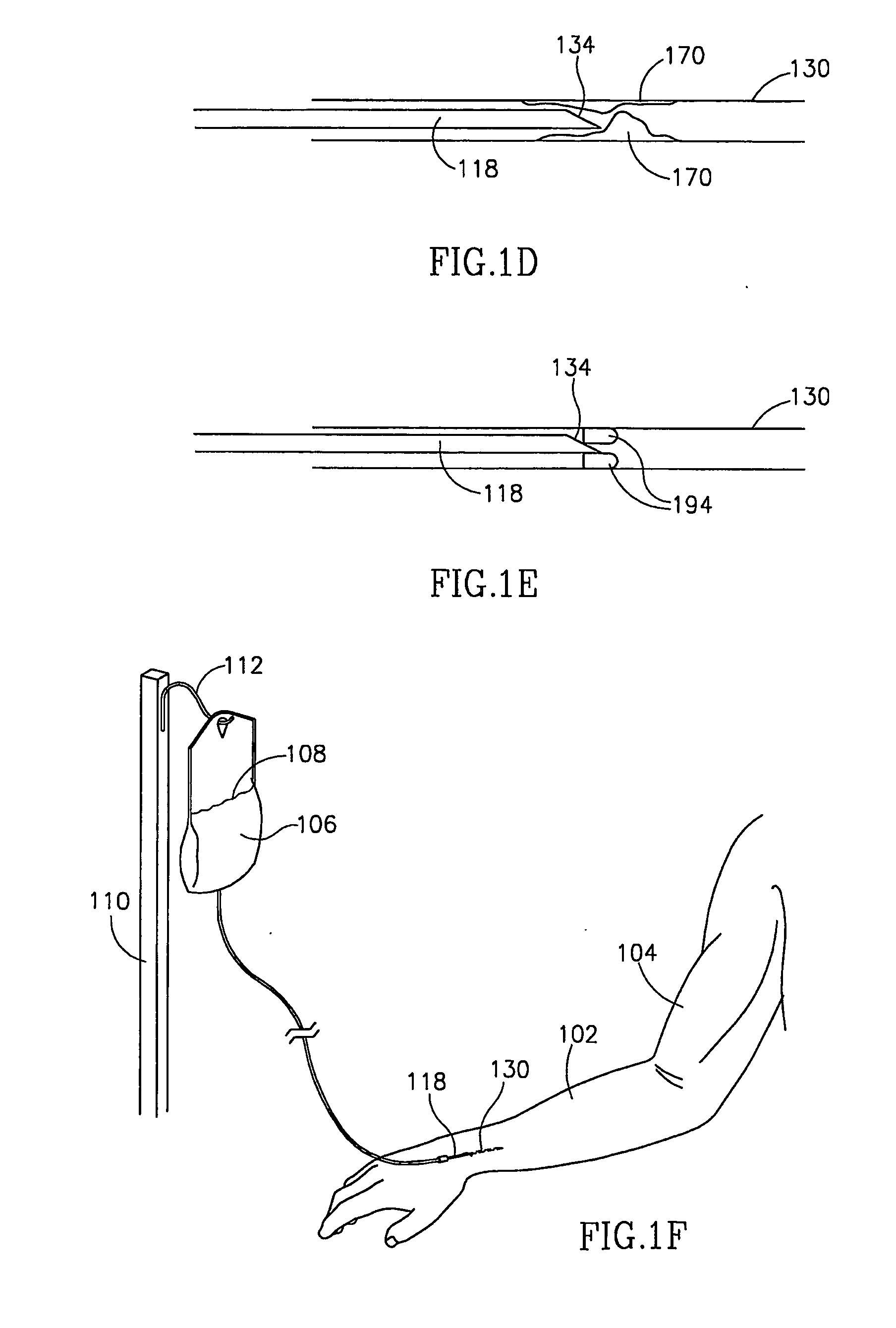 Vascular coupling device