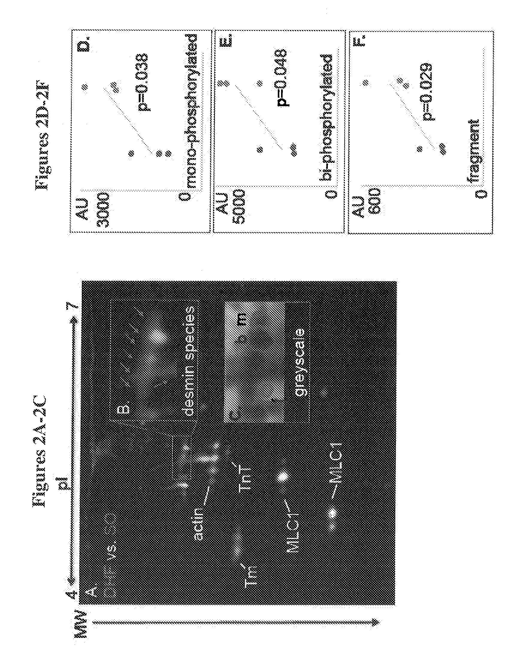 Novel desmin phosphorylation sites useful in diagnosis and intervention of cardiac disease