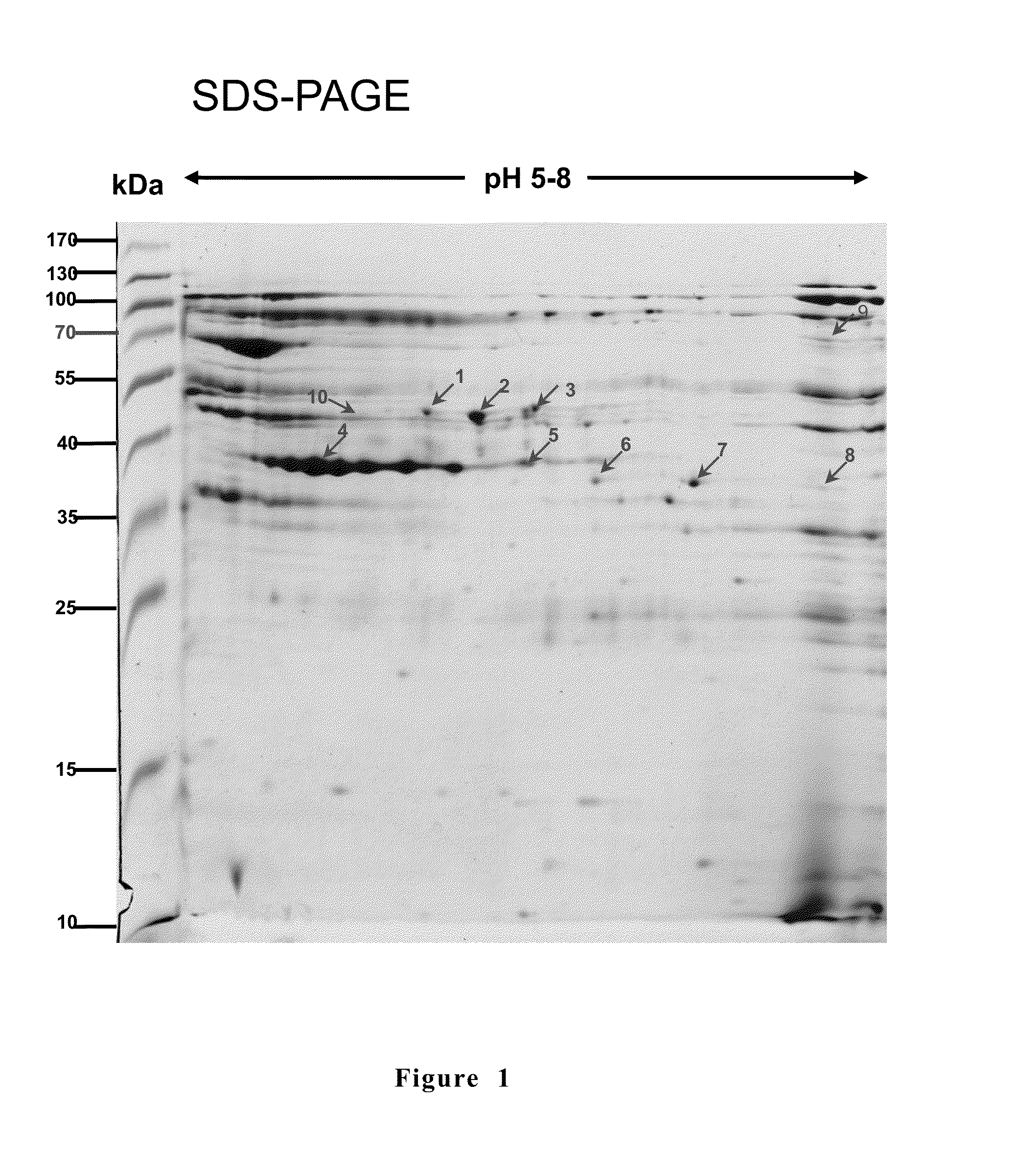 Anti-mycoplasma spp. subunit vaccine