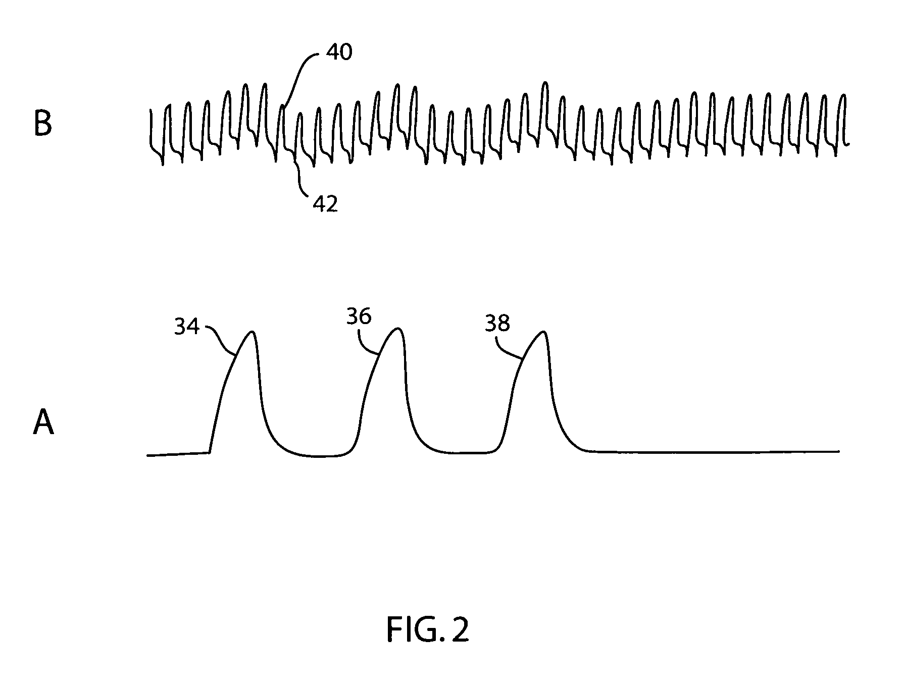 Automatic calibration of blood volume status indicators