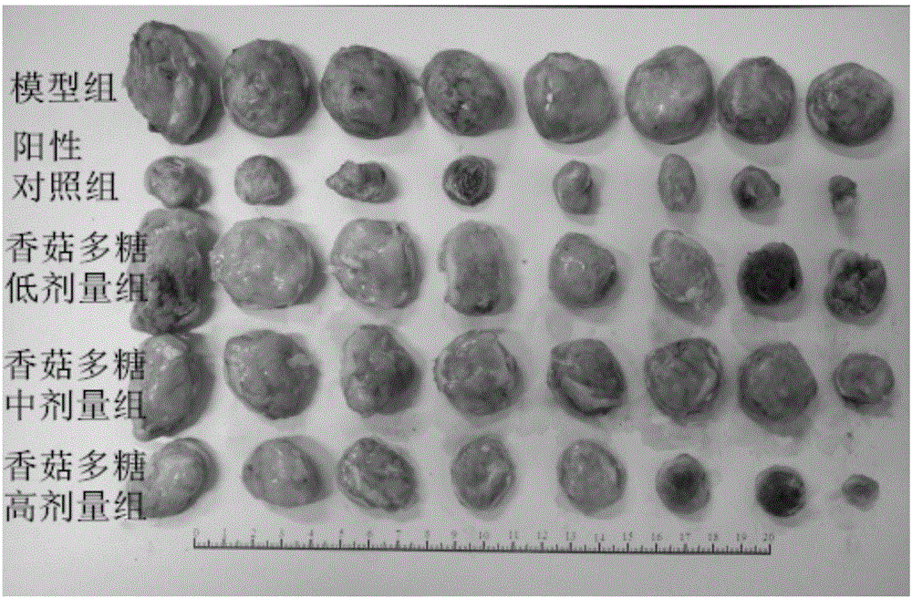 Lentinan with liver cancer resisting and immunity improving actions and preparation method thereof