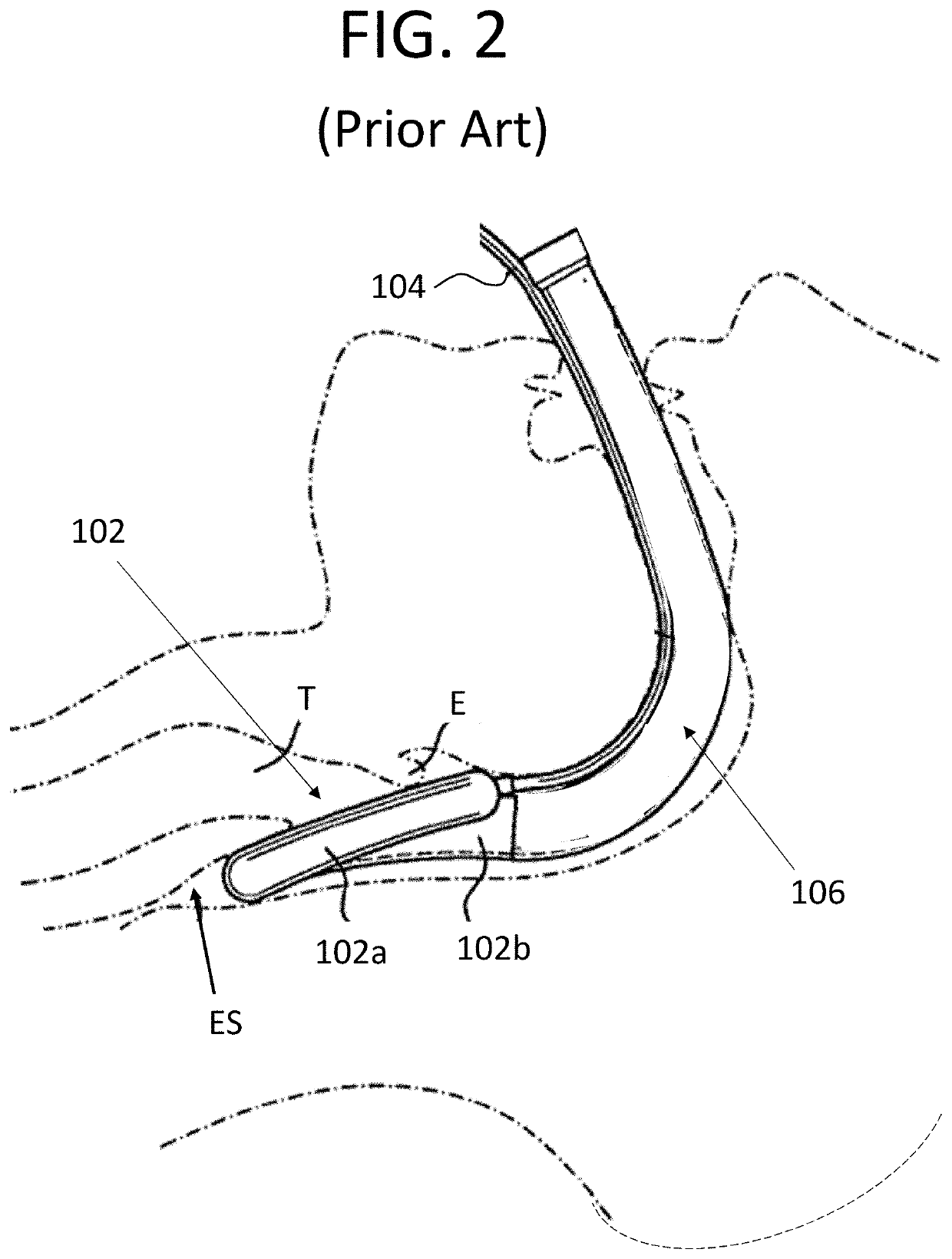 Tracheoscope control device, laryngeal mask airway device, and combination system thereof