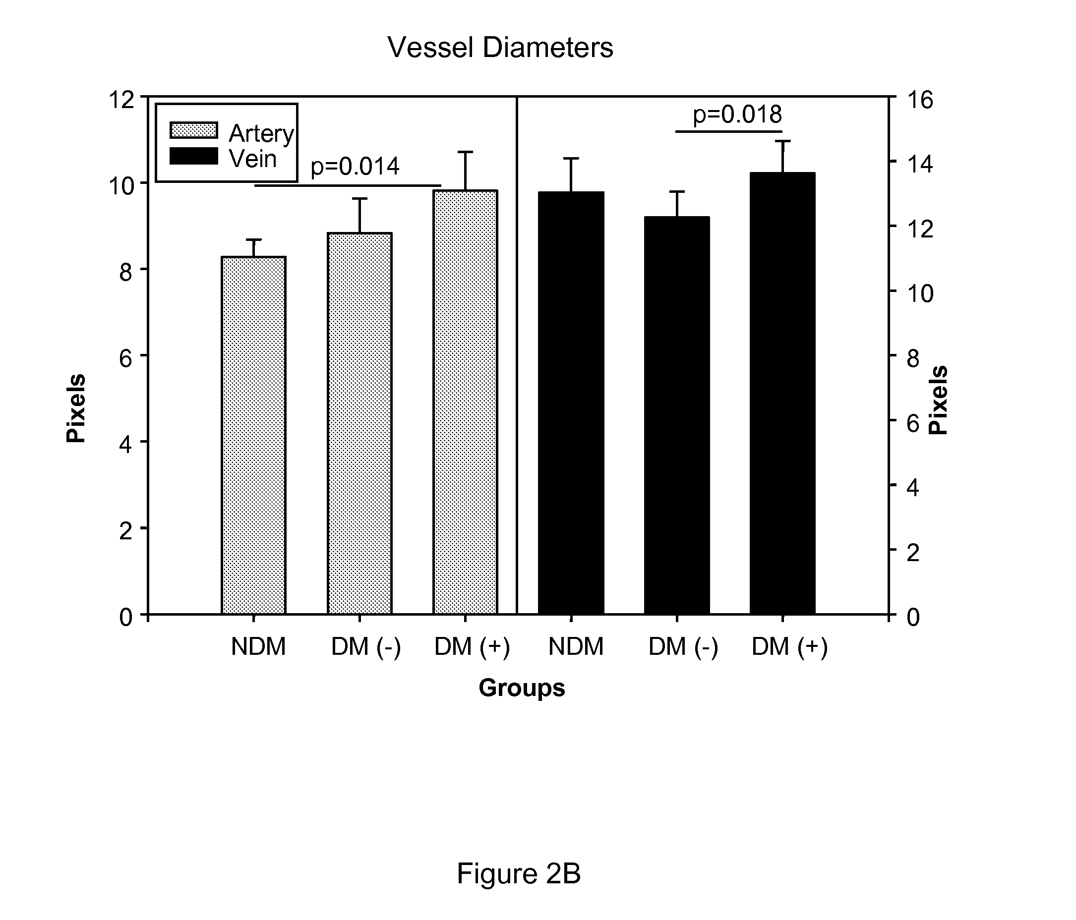 Method for reducing blood pressure using inhibitors of plasma kallikrein