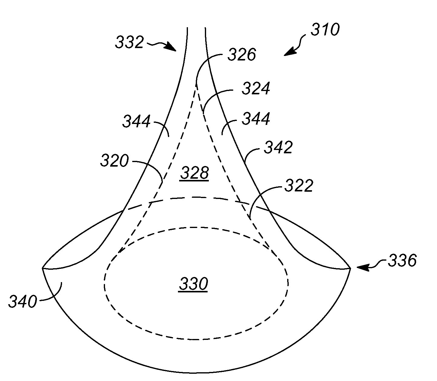 Vessel, system, and process for minimizing unequal flow distribution