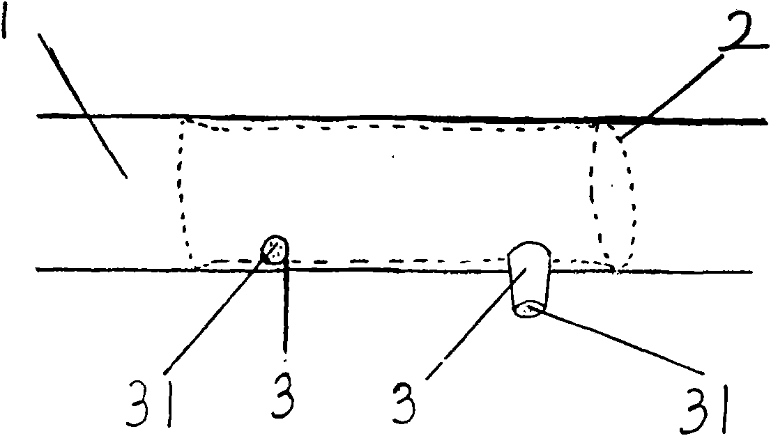 Filtration irrigation device