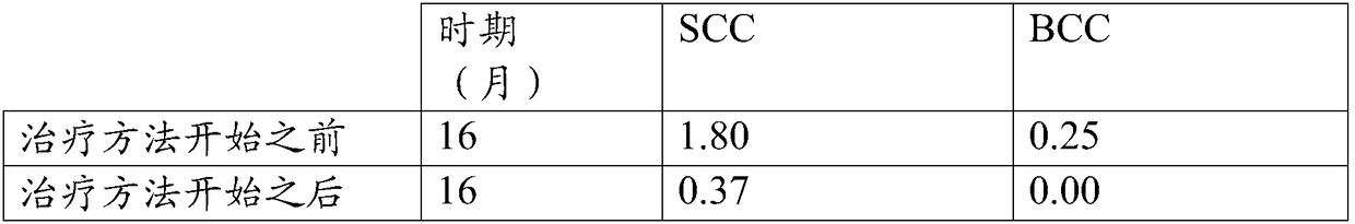 Method and composition for treating cancer or skin lesion using vaccine