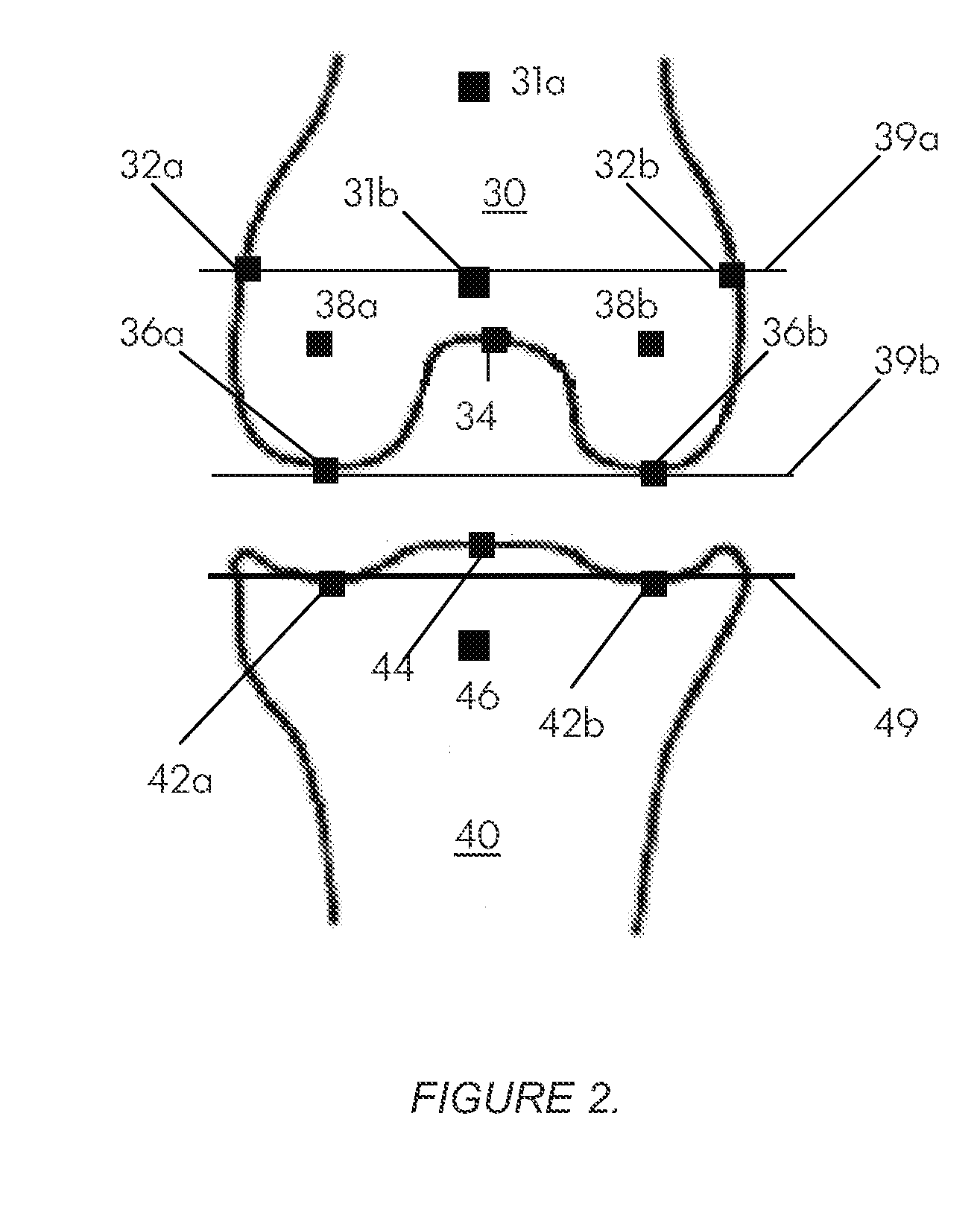 Systems and methods for determining the mechanical axis of a femur