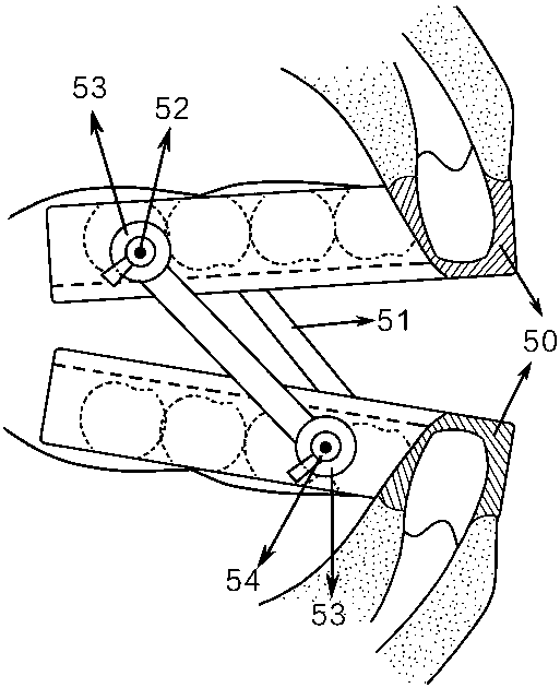 Oriented externally-adjustable snore-ceasing equipment