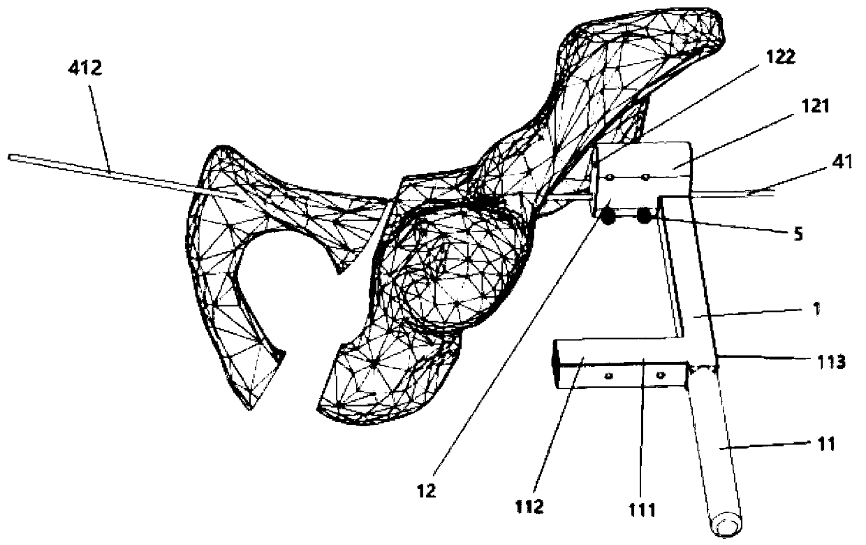 Pelvic fracture reduction device and operating method