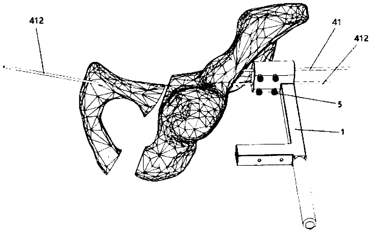 Pelvic fracture reduction device and operating method