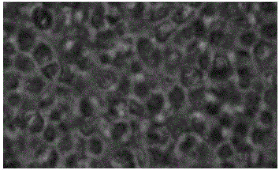 Isolated culture method of chicken intestinal tract epithelial GammaDeltaT cells