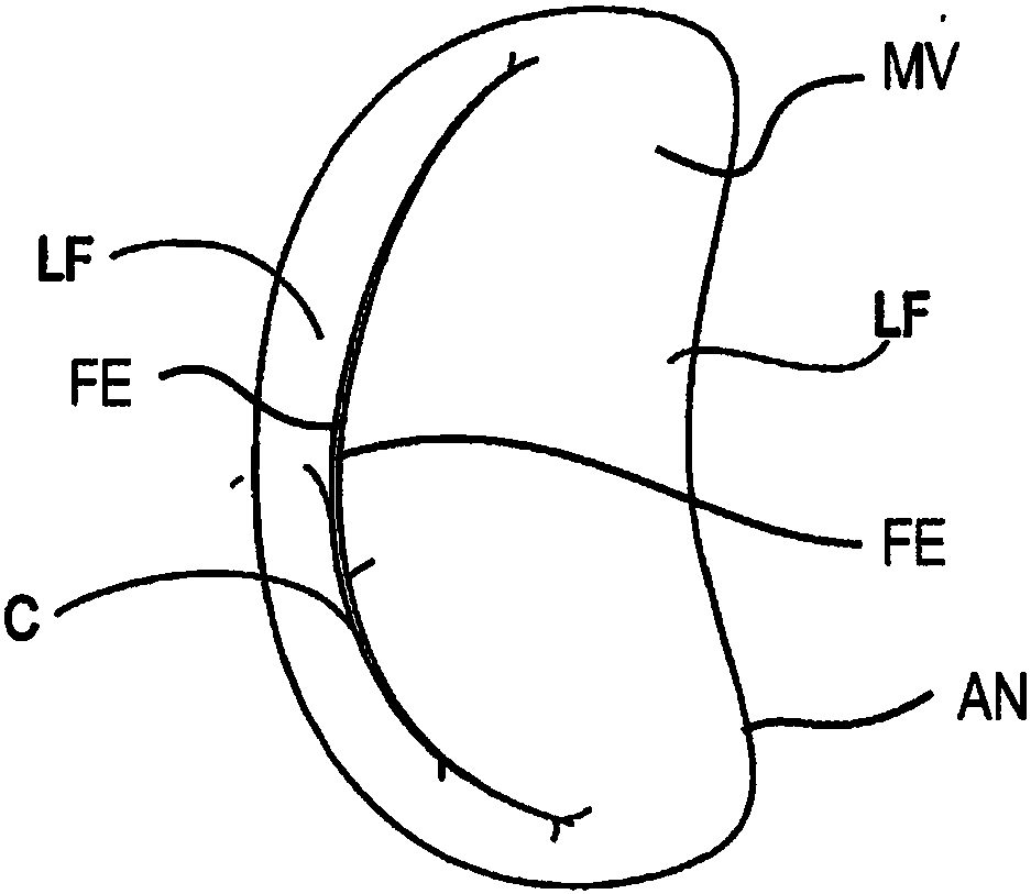 Improved tissue fixation devices