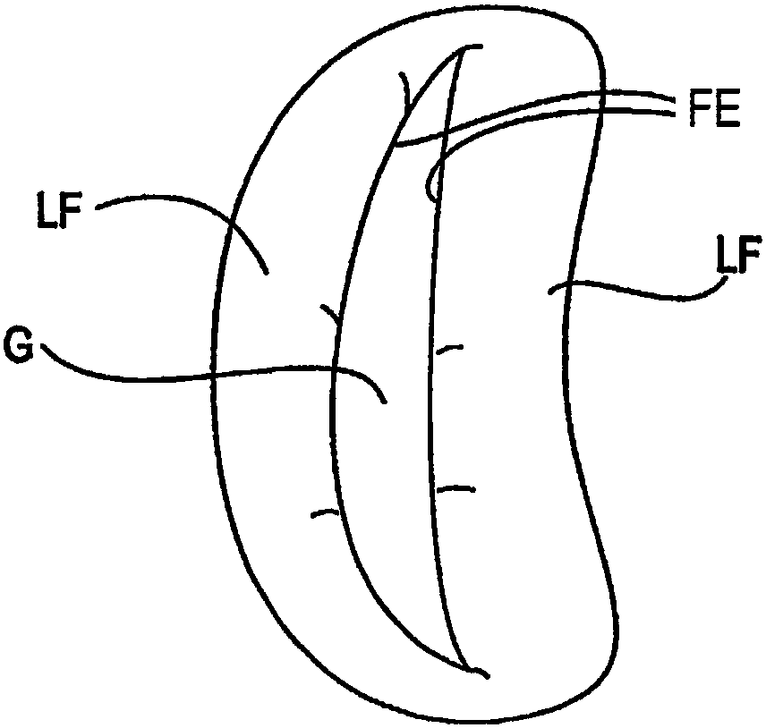 Improved tissue fixation devices