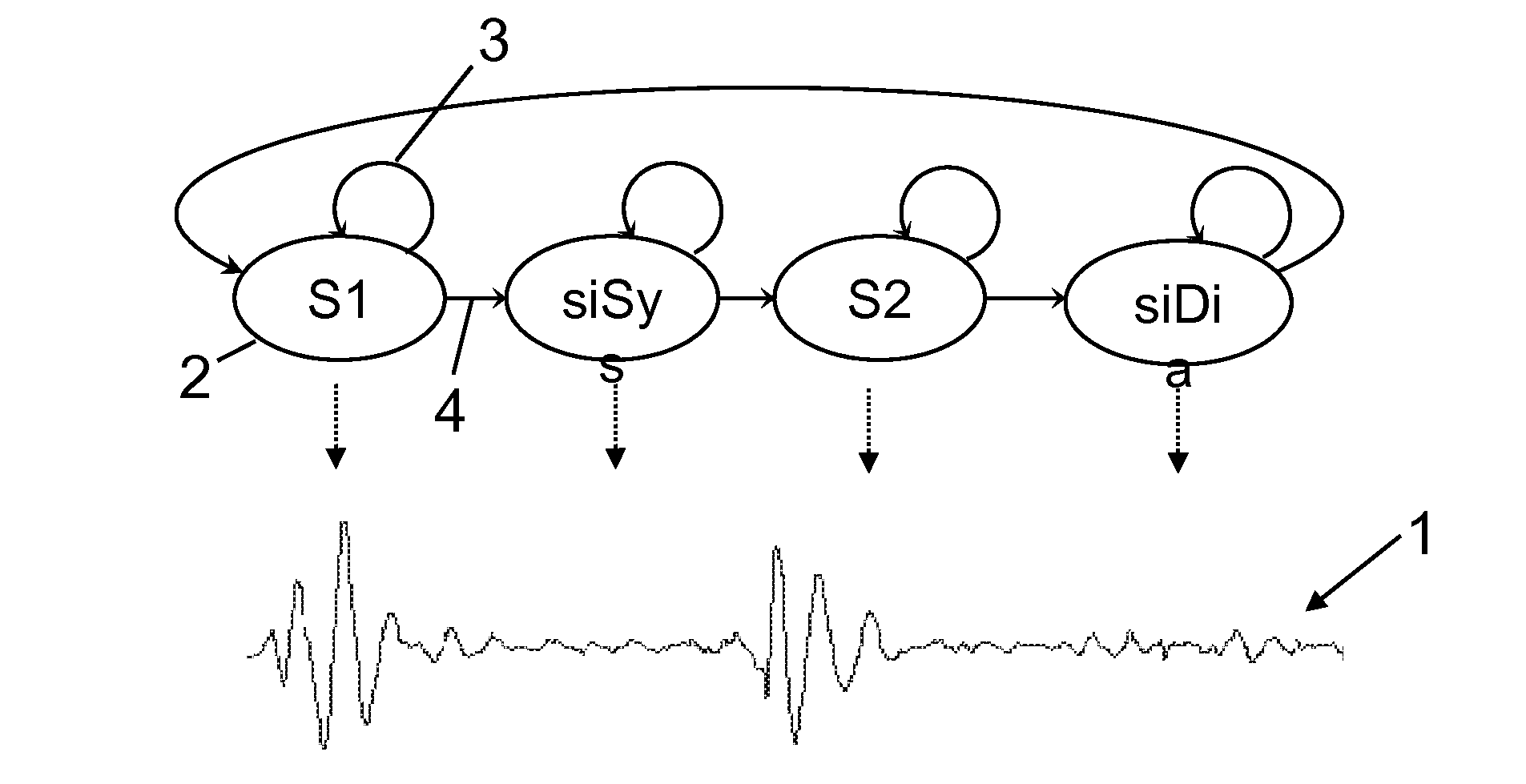 Segmenting a cardiac acoustic signal